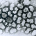 Transmission electron micrograph of influenza A virus, late passage - CDC-Dr. Erskine Palmer, 1981